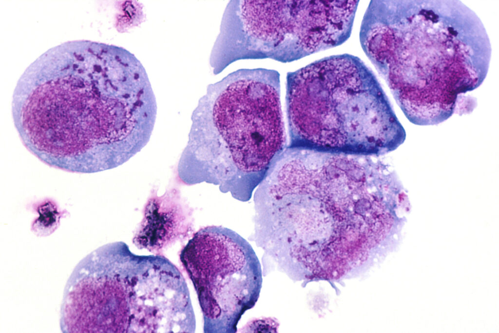 PROKARYOTIC CELLS- INCLUSION BODIES