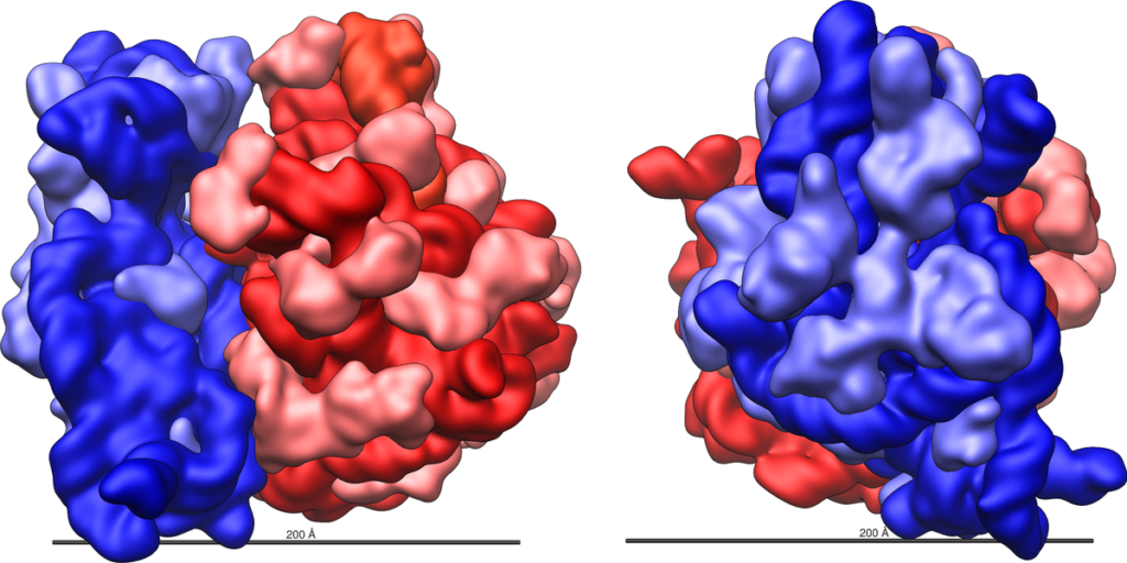 PROKARYOTIC CELLS -RIBOSOMES