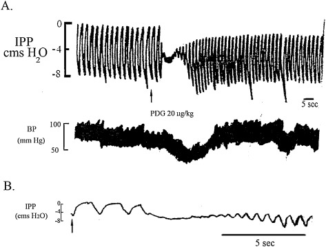 Regulation of respiration-Juxtapulmonary-capillary receptors